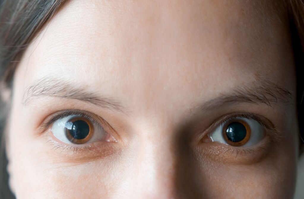 Woman with dilated pupils.