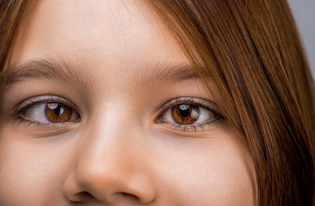 Close-up of a child's eyes with strabismus.